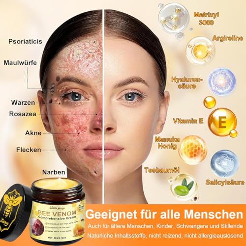 Crème de régénération de la peau au venin d'abeille 2025 - Traitement professionnel pour tous les types de peau - Ameill